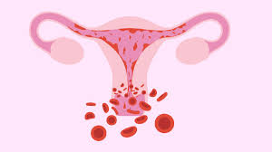 Abnormal Uterine Bleeding Treatment